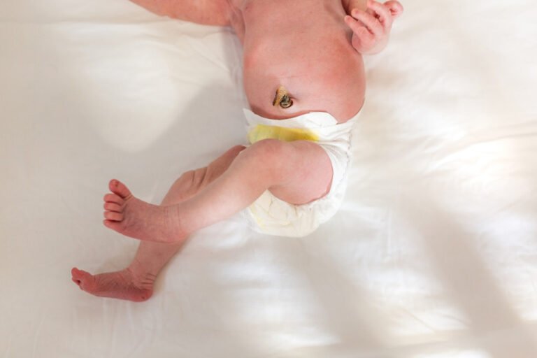 What Happens To The Baby's Umbilical Cord After Birth?