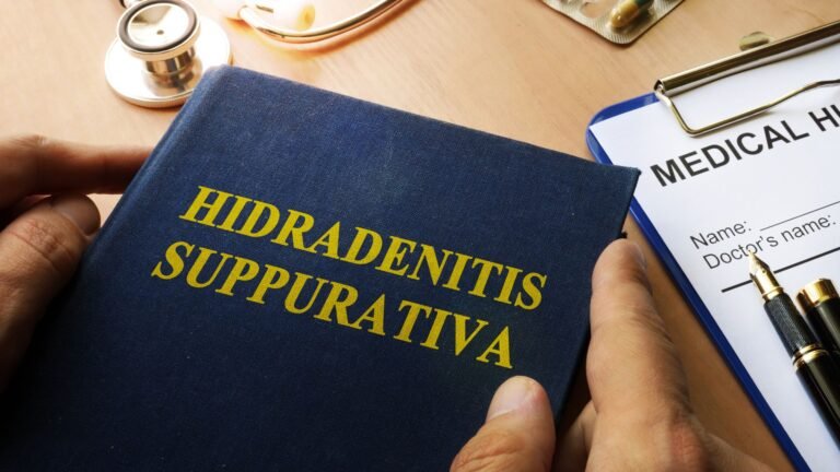 Is Hidradenitis Suppurativa Contagious? Debunking Misconceptions – Amazing Ointments