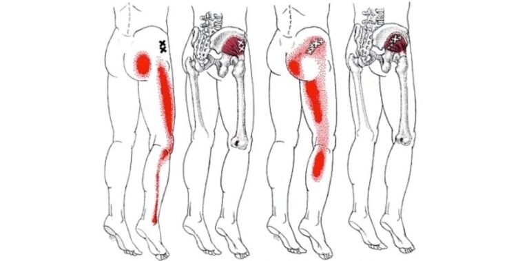 10 Piriformis Stretches For Sciatica Relief