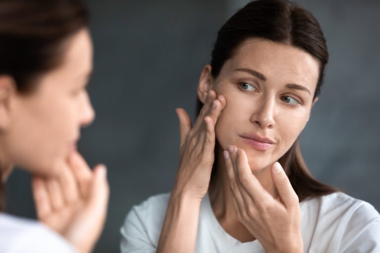 How Acne Treatment Transforms Mental Health