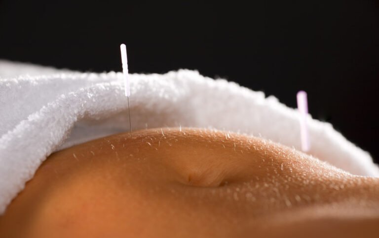 5 Effective Acupuncture Points For Erectile Dysfunction