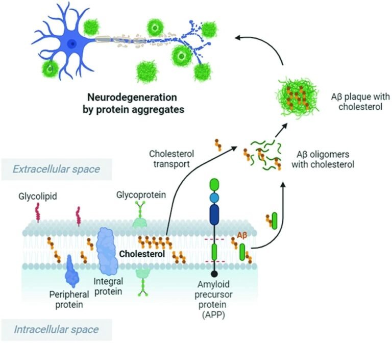 Cholesterol Imbalance Linked To Neurodegeneration, Study Suggests Potential Strategies For