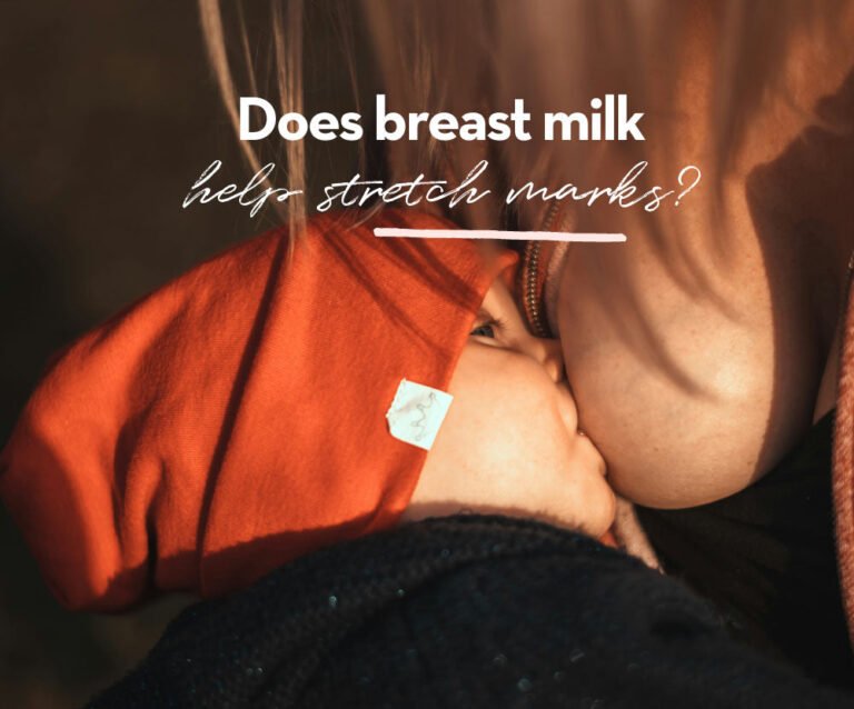 Does Breast Milk Help Stretch Marks?