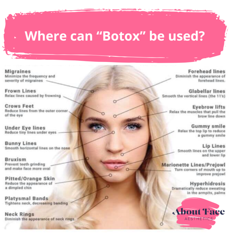 Top 10 Most Popular Facial Botox Injection Sites