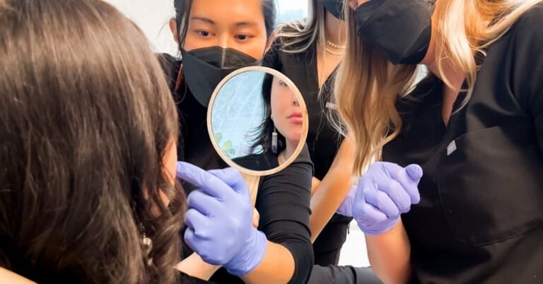 Are The Effects Of Microneedling Permanent?