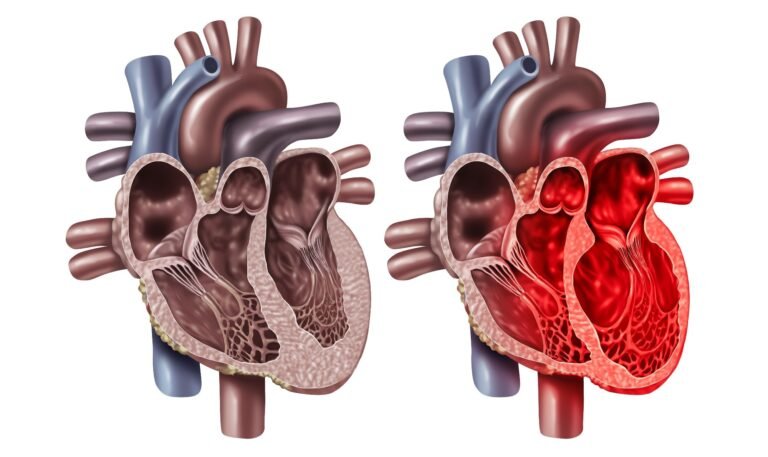 Us Hospitals See Increasing Complications In Patients With Takotsubo Cardiomyopathy