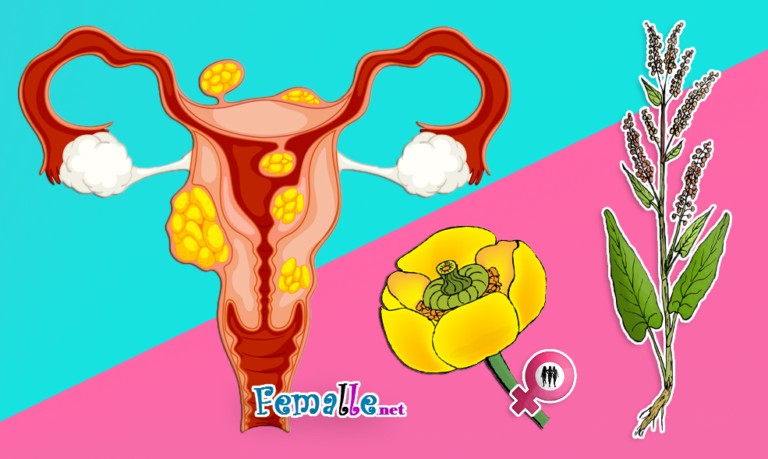 6 Innovative Home Treatments To Improve Your Uterine Fibroids