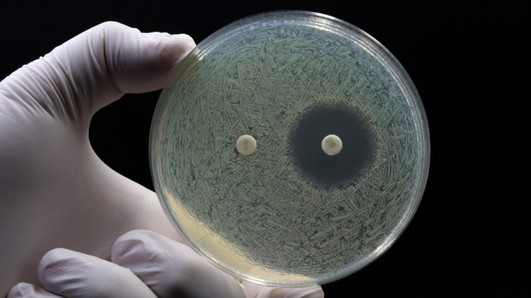 New Doxy Pep Study Links To Increasing Resistance To Antibiotics