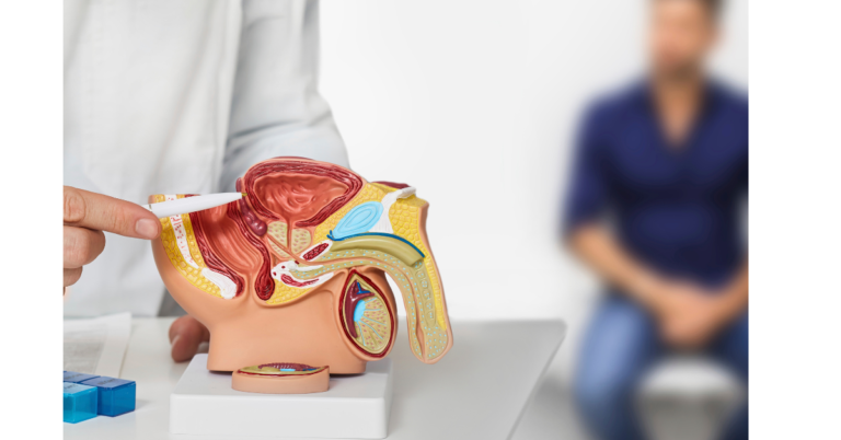 Prostate Cancer And Erectile Dysfunction￼