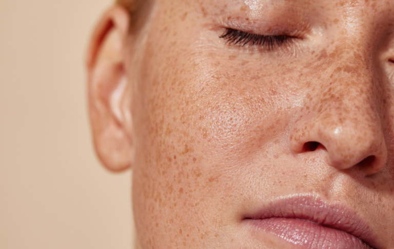All For Your Sunlight And Skin