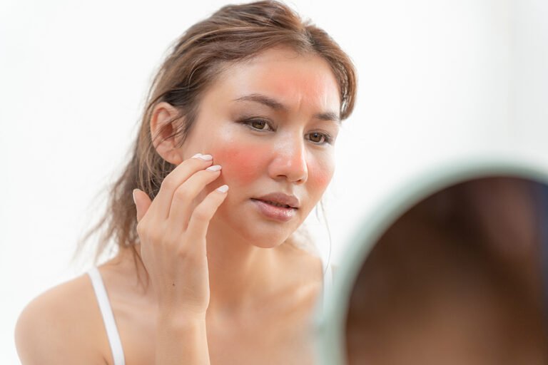 How To Repair The Skin Damaged Skin