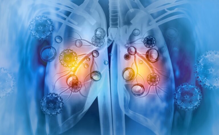 Respiratory Viruses Awaken Inert Breast Cancer Cells And Increase The
