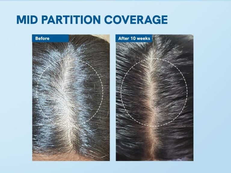 Be Bodywise Hair Care Routine For Women To Support Healthy