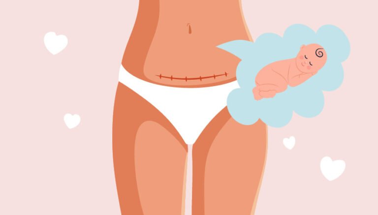 How Will My Baby Affect?