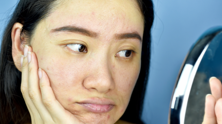 What Skin Cells Do They Really Do? And How Your