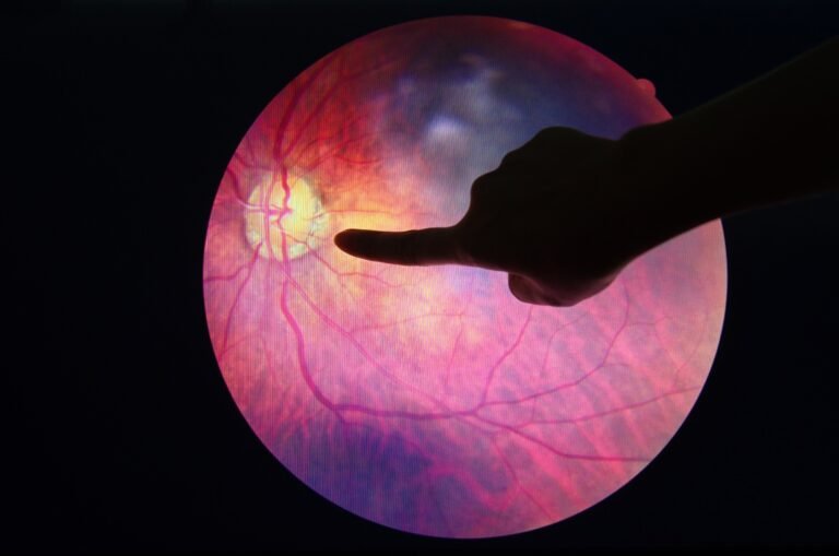 AI-driven eye screening aims to close diabetes vision gap in community clinics Ai Driven Eye Screening Aims To Close Diabetes Vision Gap In