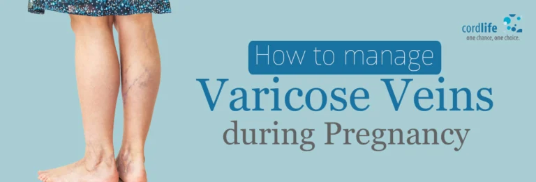 How to manage varicose veins during pregnancy naturally! How To Manage Varicose Veins During Pregnancy Naturally!
