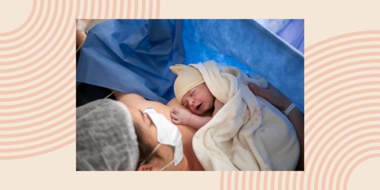 Study finds caesarean section may increase risk of sleep disorders Study Finds Caesarean Section May Increase Risk Of Sleep Disorders