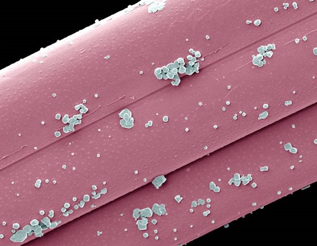 Revolutionizing bone regeneration using nanoparticle-stem cell hybrid Revolutionizing Bone Regeneration Using Nanoparticle Stem Cell Hybrid