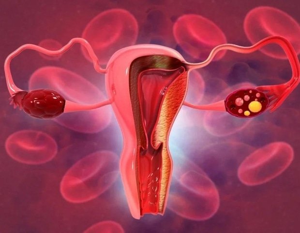 New study charts pathways to end cervical cancer New Study Charts Pathways To End Cervical Cancer