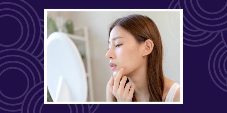 Pregnancy acne is real – and a dermatologist says you don’t just have to ‘wait it out’ Pregnancy Acne Is Real And A Dermatologist Says You