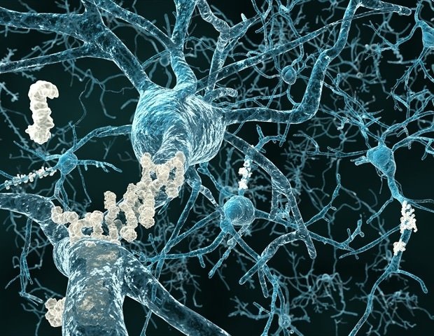 Restoring brain energy balance reverses Alzheimer’s disease in mouse models Restoring Brain Energy Balance Reverses Alzheimer's Disease In Mouse Models