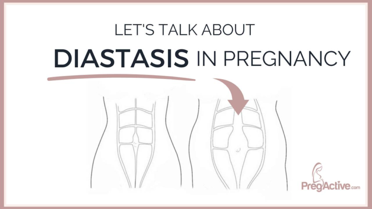 Diastasis Recti How To Fix Abdominal Separation During Pregnancy