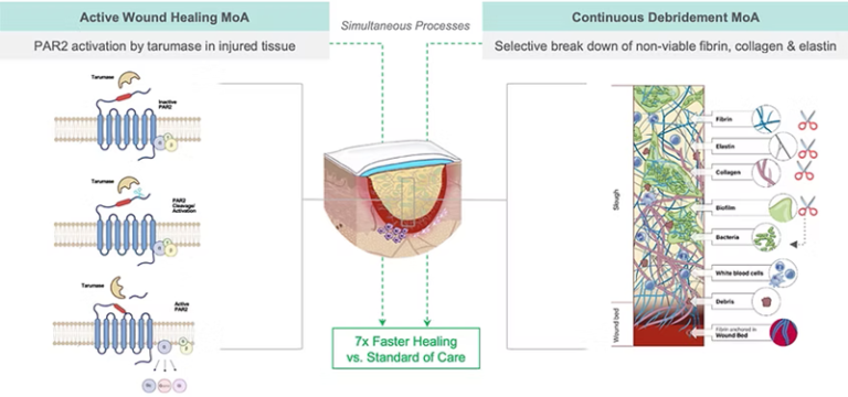 Solascure Completes Phase Ii Clinical Trial, Demonstrating Accelerated Healing With