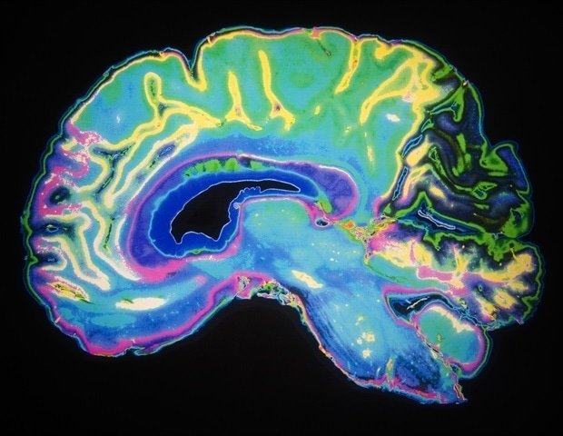 Scientists have proposed a new theory of brain development Scientists Have Proposed A New Theory Of Brain Development