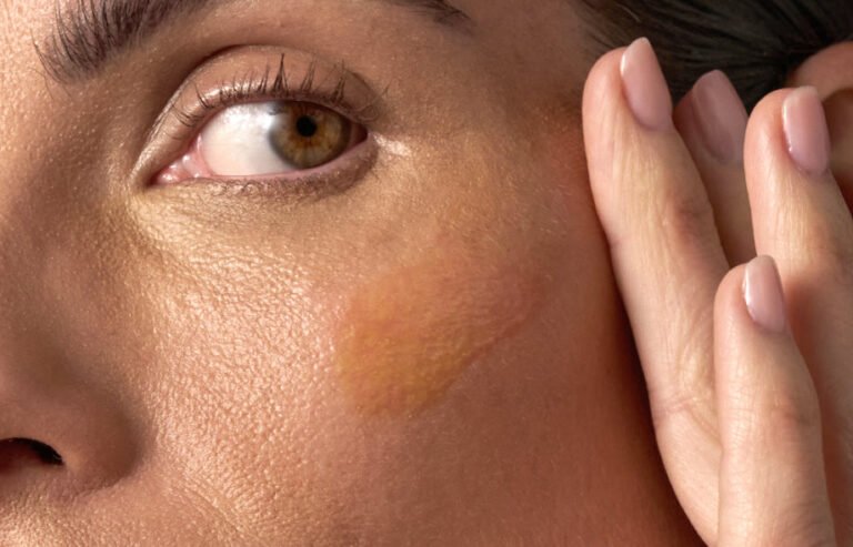 5 Reasons Why Dermatologists Prefer Retinal – Tropic Skincare