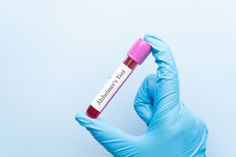 Identifying The Ages At Which Alzheimer's Biomarkers Change Sharply