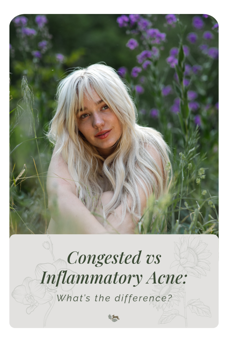 Congested Vs. Inflammatory Acne: How To Tell The Difference