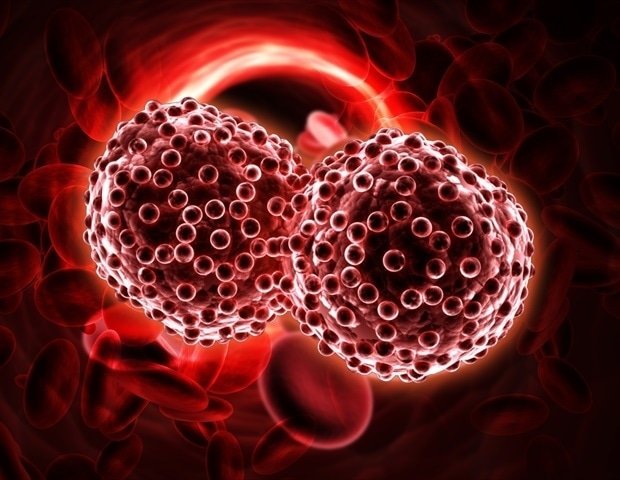 New study redefines high-risk criteria for multiple myeloma New Study Redefines High Risk Criteria For Multiple Myeloma
